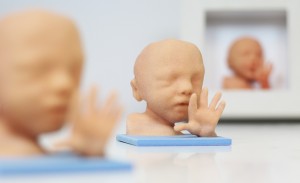 3D Unborn Baby