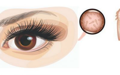 Eyelash Mites Are A Real Thing and Yeah, You Probably Have Them