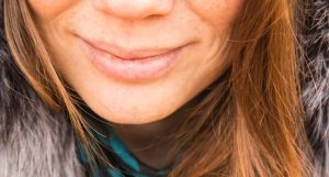 Natural Cold Sore Remedies